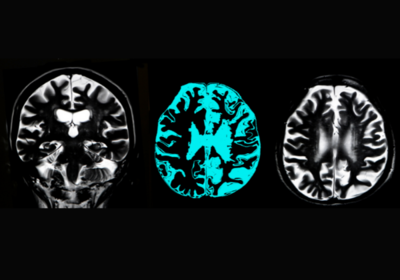 white and blue brainscan images