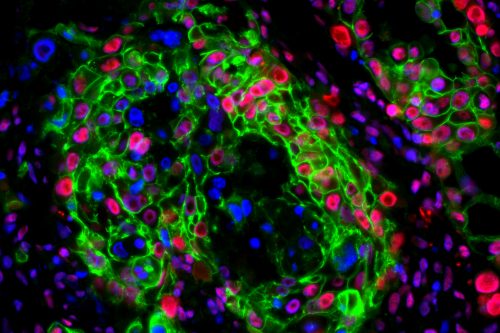 colorful image of human PDAC slice culture