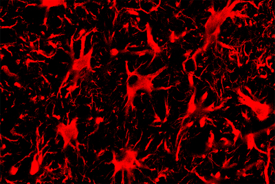 red and black spinal cord astrocytes