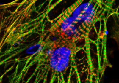 Human induced pluripotent stem cell-derived heart cells (cardiomyocytes) show the cardiac proteins actinin (red) and troponin T (green) as well as the nucleus (blue).