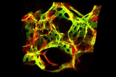 red, yellow and green flourescence microscopy image of lung
